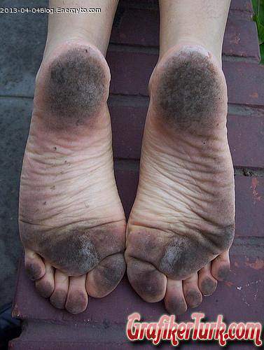 dirty-feet by BrianFitzpatrick885
